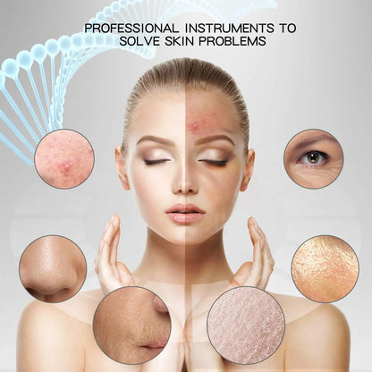fachgo | Newest Electronic Face Skin Cleaning Instrument Ultrasonic Visage Exfoliator Scrubber Beauty Products for Women Home Use