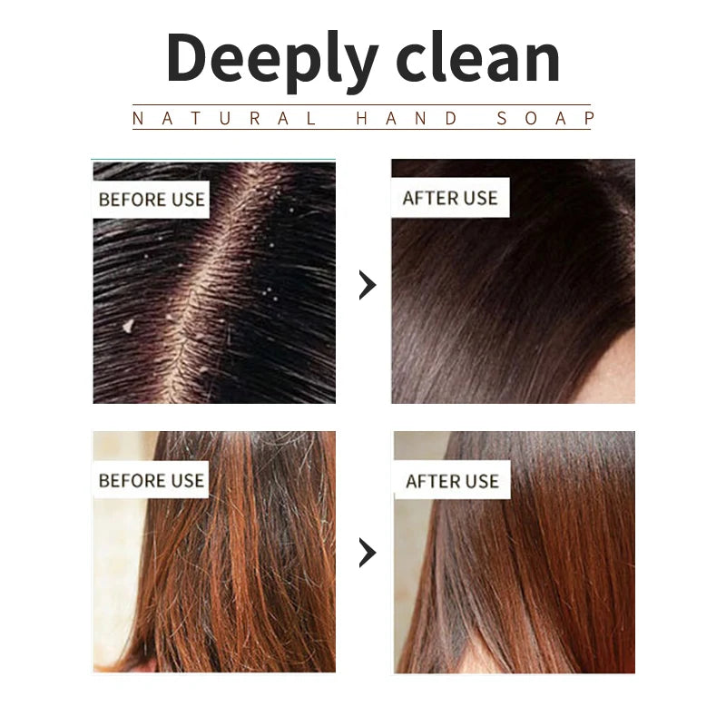 fachgo | Rosemary shampoo soap without silicone oil plant shampoo soap cleanses the scalp nourishes hair controls oil