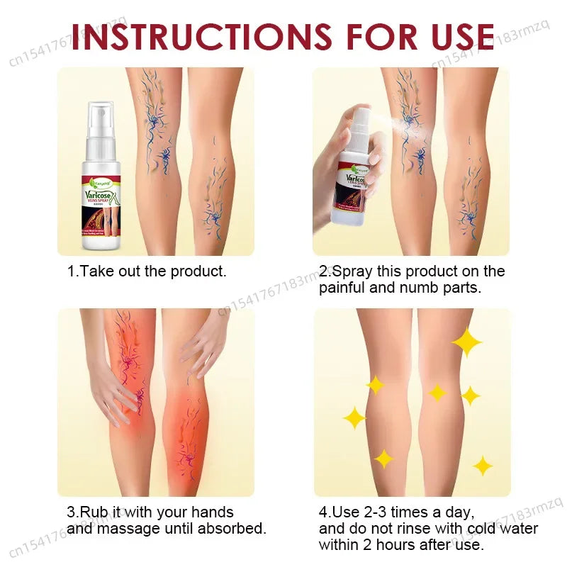 fachgo | Leg Care Treatment Cream Improve Varicose Veins To Relieve Leg Swelling and Pain Body Care Relieve leg discomfort