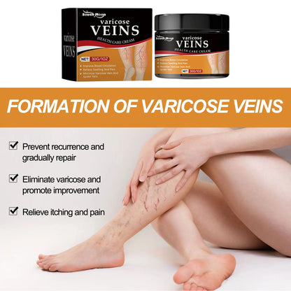 fachgo | Leg Treatment Cream Reducing Varicose Veins Remove Redness Repair Phlebitis Relieves Bulge Improving Circulation Body Care Cream