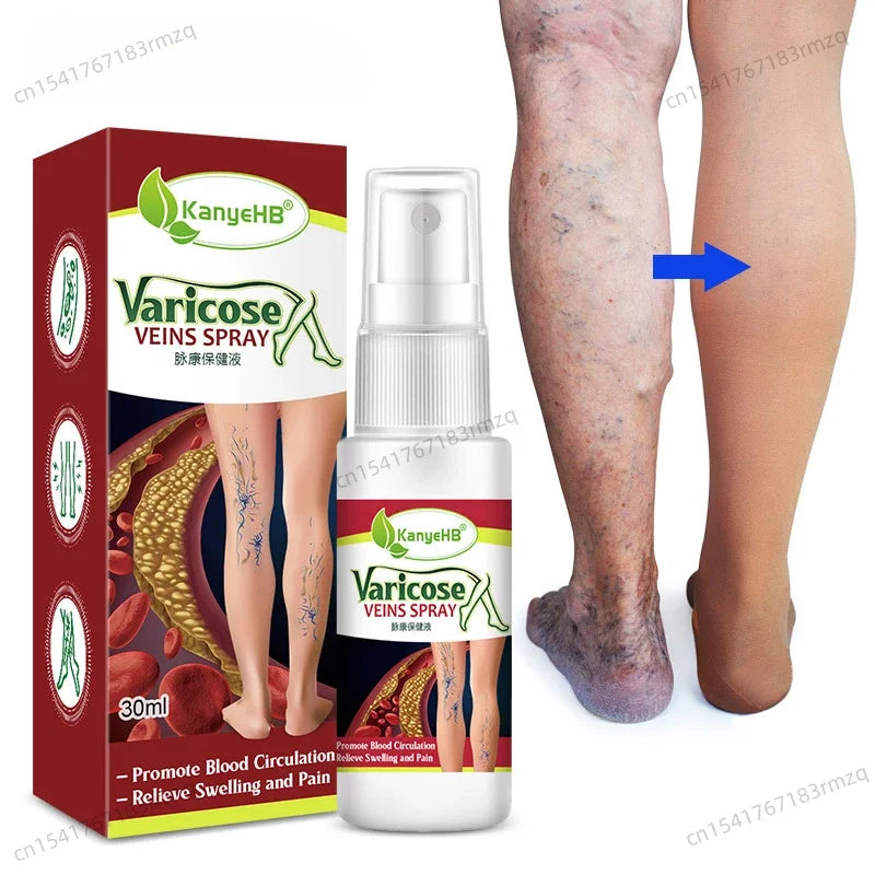 fachgo | Leg Care Treatment Cream Improve Varicose Veins To Relieve Leg Swelling and Pain Body Care Relieve leg discomfort