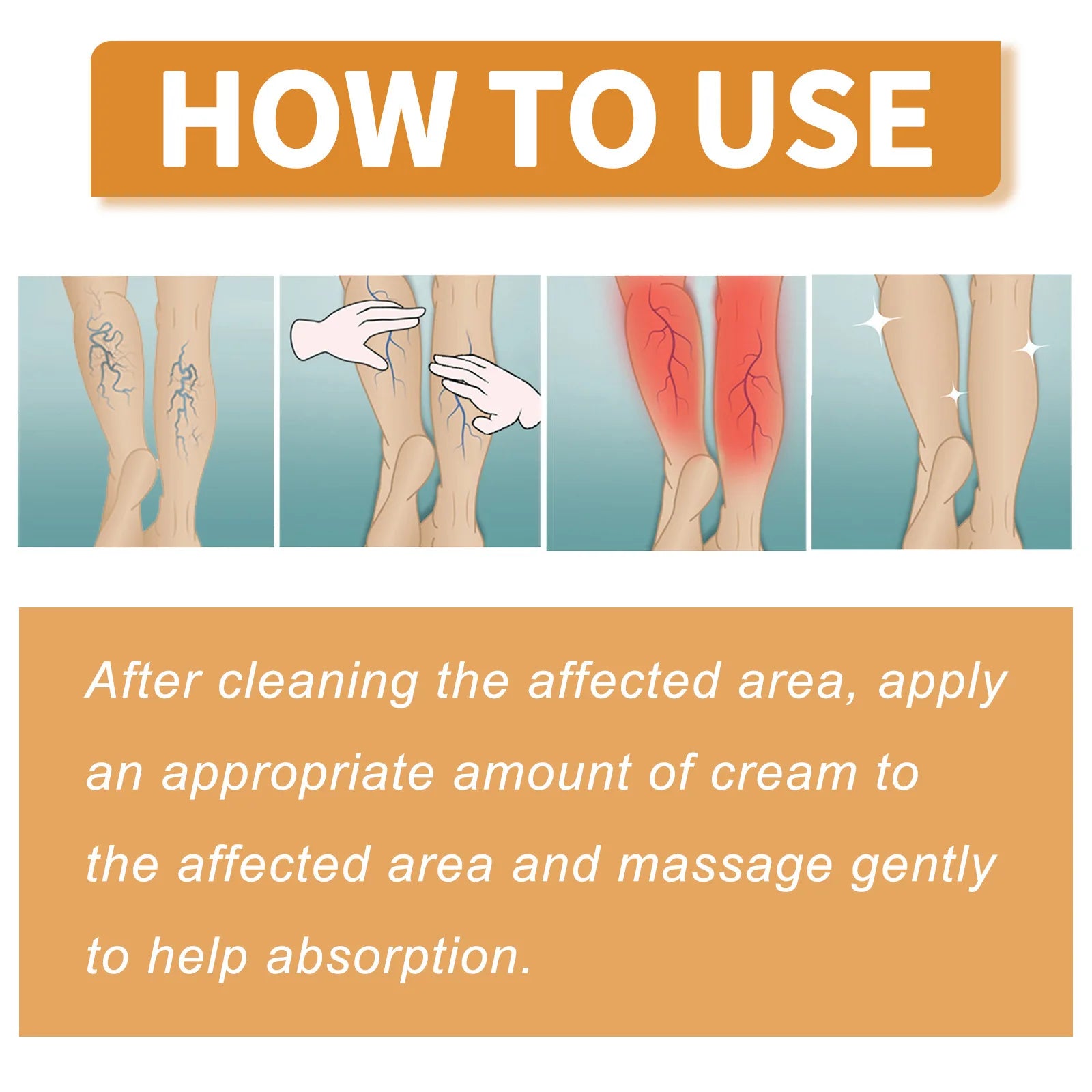 fachgo | Leg Treatment Cream Reducing Varicose Veins Remove Redness Repair Phlebitis Relieves Bulge Improving Circulation Body Care Cream