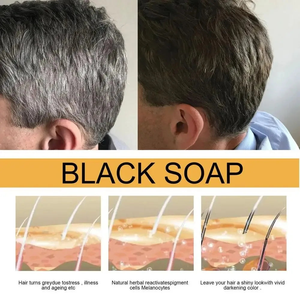fachgo | Hair Shampoo Soap Polygonum Multiflorum Black Soap White Hair Repair Soap Hair Care Set Nourishing Anti Dandruff Hair Dye Soap