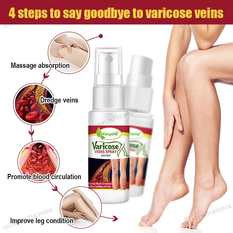 fachgo | Leg Care Treatment Cream Improve Varicose Veins To Relieve Leg Swelling and Pain Body Care Relieve leg discomfort