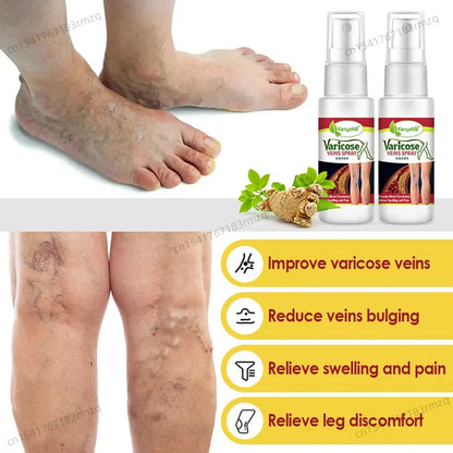 fachgo | Leg Care Treatment Cream Improve Varicose Veins To Relieve Leg Swelling and Pain Body Care Relieve leg discomfort